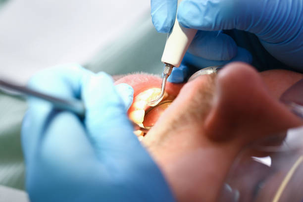 Best After-Hours Emergency Dentist in Lumberton, MS