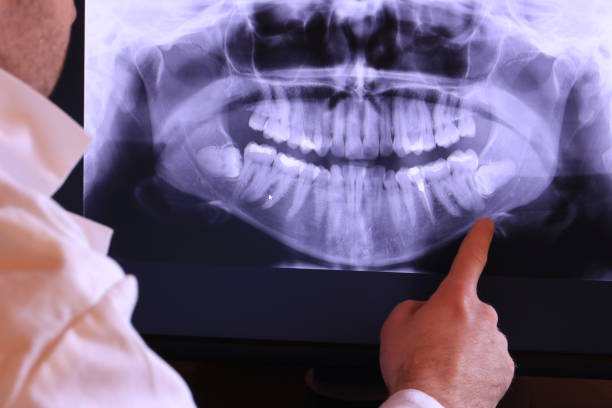Best Pediatric Emergency Dentist in Lumberton, MS